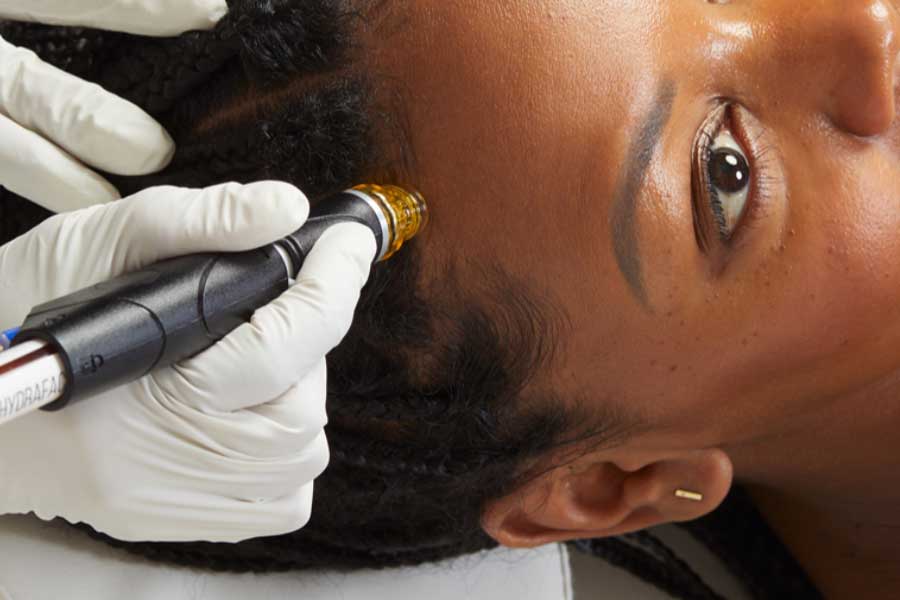 Scalp & Beard Treatment -image